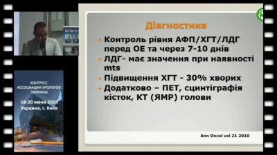 Возиванов С.О. - Современные методы лечения больных семиномой яичка
