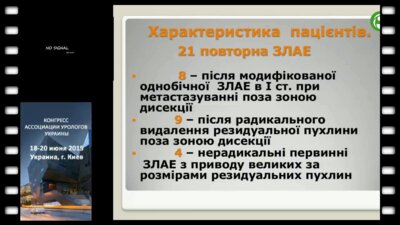 Сакало А.В. - Повторная забрюшинная лимфаденектомия у больных с несеминомной опухолью яичка