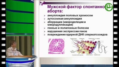 Божедомов В.А. - Андрологические аспекты невынашивания беременности