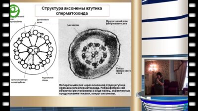 Брагина Е.Е. - Генетически обусловленные формы спермопатологии, выявляемые при ультраструктурных исследованиях