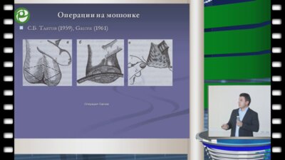 Гвасалия Б.Р. - Хирургическое лечение варикоцеле. Обзор методов. Золотой стандарт оперативного лечения