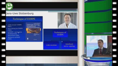 Новиков А.Б. - Лапароскопическая радикальная простатэктомия, варианты доступа