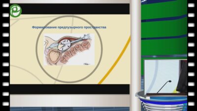 Попов С.В. - Лапароскопическая простатэктомия 2015