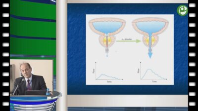 В.В. Данилов - Роль измерительных уродинамических методик в выборе метода лечения у больных АПЖ