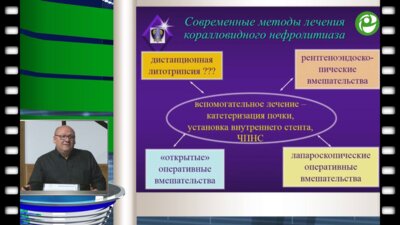 Мартов А.Г. - Перкутанное лечение коралловидного нефролитиаза