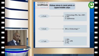 Гулиев Б.Г. - Перкутанная нефролитотрипсия под ультразвуковым контролем