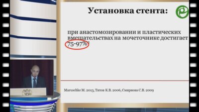 Шкодкин С.В. - Стентирование верхних мочевых путей