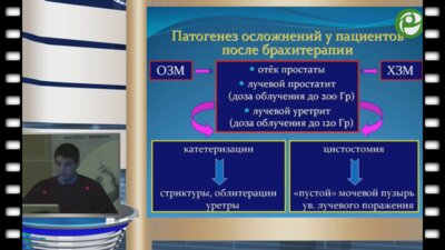 Абдуллаев Д.А. - Эндоскопическая диагностика и лечение обструктивных осложнений после радикальной простатэктомии