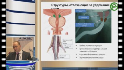 Котов С.В. - Коррекция недержания мочи после радикальной простатэктомии