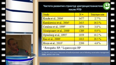Джалилов Д.О. - Трансуретральные методы коррекции обструктивных осложнений простатэктомии