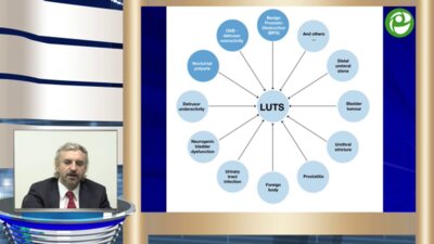 Образовательная лекция профессора Кривобородова Г.Г. на тему "Комбинированная терапия ДГПЖ: что нового?"