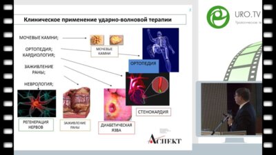 Винаров А.З. - ДУВТ – новый эффективный метод лечения больных с эд или фикция?