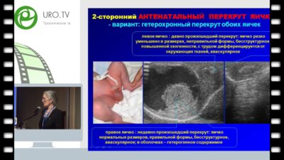 Ольхова Е.Б. - Редкие варианты острой скротальной патологии