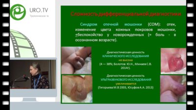 Юткина М.С. - Перекрут яйчка у детей, возможности ультразвуковой диагностики