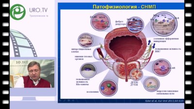 Образовательная лекция д.м.н., профессора Новикова А.И. «Комбинированная терапия ДГПЖ – что нового в 2016 году?»