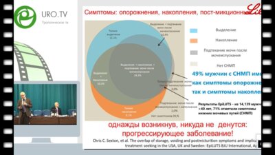Спивак Л.Г. - Ошибки консервативной терапии гиперплазии простаты