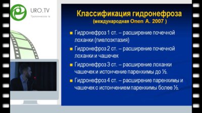 Марухненко Д.В. - Малоинвазивные оперативные вмешательства при лечении гидронефроза у детей