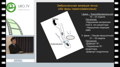 Морозов Д.А. - Контроль репродуктивной системы мальчиков с крипторхизмом