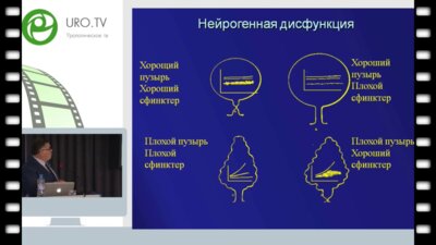 Tekgul S. - Нейрогенная дисфункция мочевого пузыря