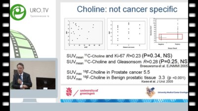 Де Йонг Я. - Современные технологии визуализации рака предстательной железы