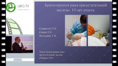 Свиридов П.В. - Брахитерапия рака предстательной железы под КТ контролем. 10 лет собственного опыта.
