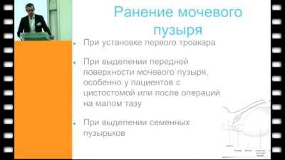 Данилець Р.О. - Осложнения возникающие при выполнении эндоскопической радикальной простатэктомии
