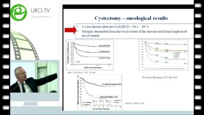M. Babjuk - Радикальная цистектомия при локализованном раке мочевого пузыря