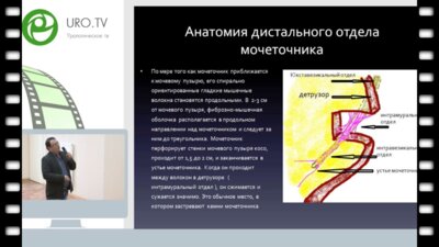 Невирович Е.С. - Лапароскопическая реконструкция интрамурального отдела мочеточника при уретероцеле больших размеров