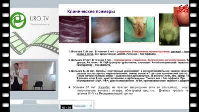 Синякова Л.А. - Ошибки консервативной терапии острого и рецидивирующего цистита