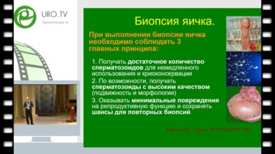 Гамидов С.И. - Варикоцеле при необструктивной азооспермии - варикоцелэктомия или микроТЕББ