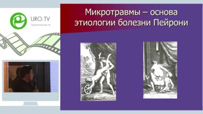 Гвасалия Б.Р. - Хирургическое лечение Пейрони