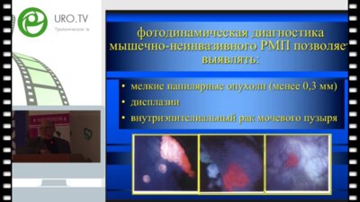 Мартов А.Г. Современные эндоскопические методы диагностики и лечения рака мочевого пузыря