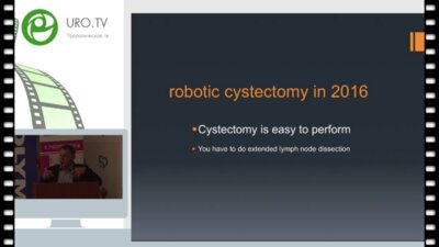 Пьер Моно Робот-ассистированная цистэктомия