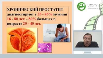 Час с ведущим урологом: Современный пациент с хроническим простатитом. Что изменилось за 20 лет?