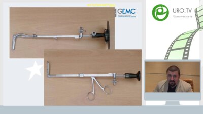 Час с ведущим урологом: Малоинвазивные методики лечения МКБ: когда, кому, чем?