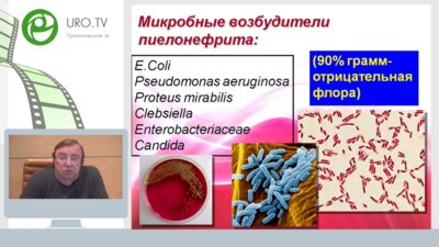 Час с ведущим урологом: Острый пиелонефрит – что должен знать уролог в 2017 году?