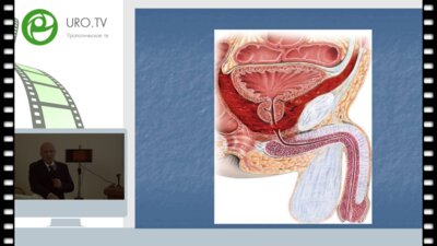 Даренков С.П. - Хирургические приёмы при посттравматических стриктурах мембранозного отдела уретры