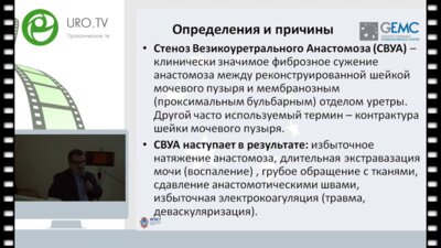Живов А.В. - Стеноз везико-уретрального анастомоза после радикальной простатэктомии