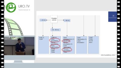 Дымов А.М. - Лазерная энуклеация гиперплазии простаты единым блоком
