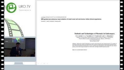 Дымов А.М. - Экспериментальное обоснование интерстициальной лазерной термокоагуляции опухоли почки