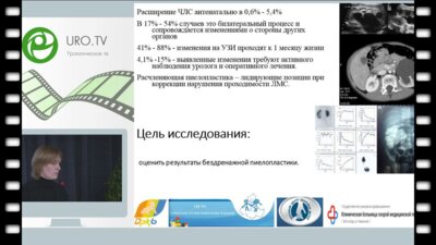 Борисова С.А. - Результативность бездренажного ведения больных с гидронефрозом по данным многоцентрового исследования