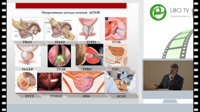 Комяков Б.К. - Осталось ли место открытой аденомэктомии среди современных методов оперативного лечения больных доброкачественной гиперплазией простаты?