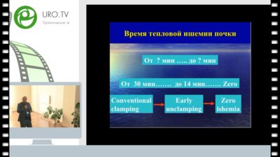 Гулиев Б.Г. - Лапароскопическая резекция почки с селективной ишемией