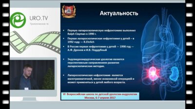 Основин П.Л. - Лапароскопическая нефрэктомия у детей
