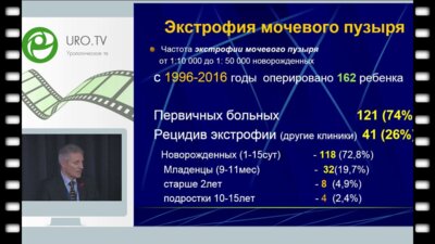 Рудин Ю.Э. - Первичное закрытие мочевого пузыря при экстрофии мочевого пузыря у новорожденных