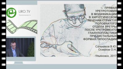 Сальников В.Ю. - Прямая уретротомия в модификации в хирургическом лечении стриктур го­ловчатого отдела уретры после уретромеатогланулопластики