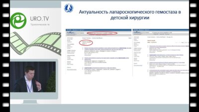 Туров Ф.О. - Оптимизация интраоперационного гемостаза при лапароскопических операциях на органах мочеполовой системы у детей