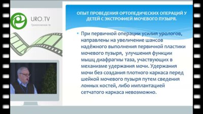 Чекериди Ю.Э. - Опыт проведения ортопедических операций у детей с экстрофией мочевого пузыря