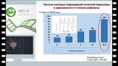 Шахновский Д.С. - Сравнительная оценка одно- и двухинъекционных методов эндоскопического лечения ПМР у детей