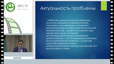 Аббасов Ш.А. - Выбор метода оперативного лечения стриктуры бульбарного отдела уретры